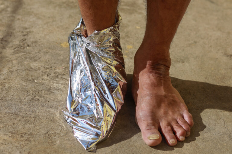 If you see someone’s feet wrapped in aluminum foil, here’s what it could mean