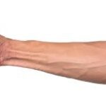 How to check if you’ve lost this tendon on your arm to evolution