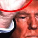 Dermatologist reveals what could be the mystery marks on Trump’s hand