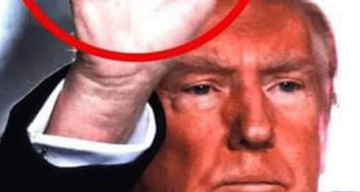 Dermatologist reveals what could be the mystery marks on Trump’s hand